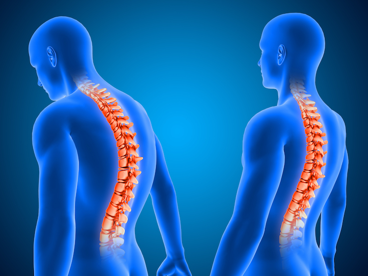 ciencia-detras-tecnica-descompresion-vertebral-impacto-columna-vertebral-1